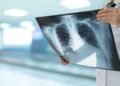 Comissão de Saúde debate incorporação da terapia tripla para tratamento da fibrose cística – Notícias