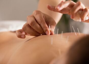 Comissão debate criação do Dia da Acupuntura e da Medicina Tradicional Chinesa – Notícias